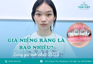 Giá niềng răng là bao nhiêu tại Gò Vấp?