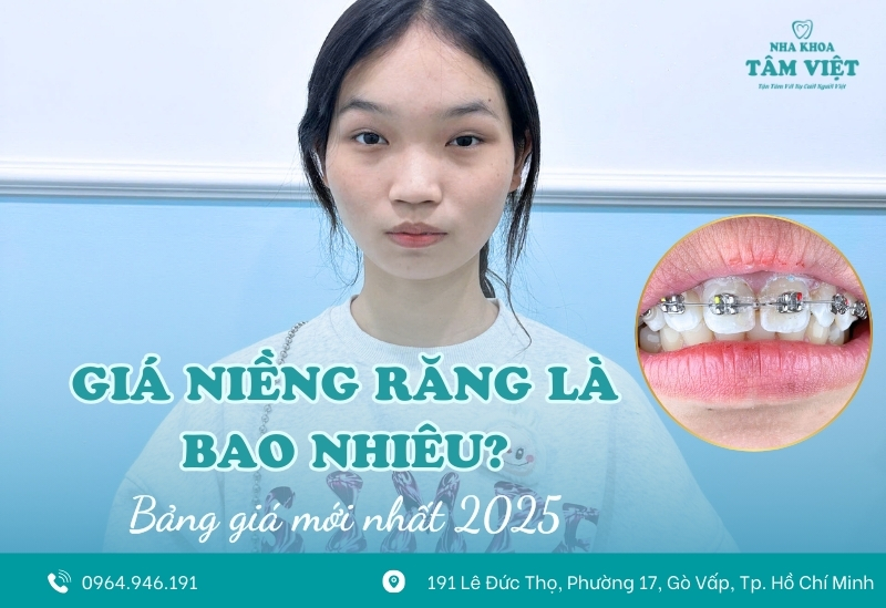 Giá niềng răng là bao nhiêu tại Gò Vấp?