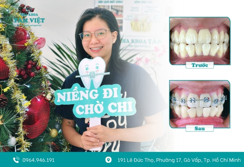 Khách hàng hài lòng sau khi niềng răng tại Tâm Việt