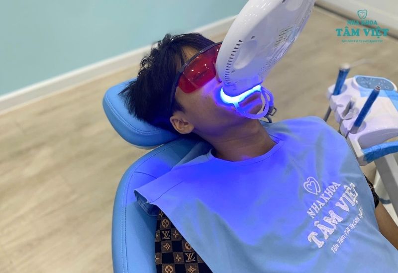Công nghệ tẩy trắng răng hiện đại