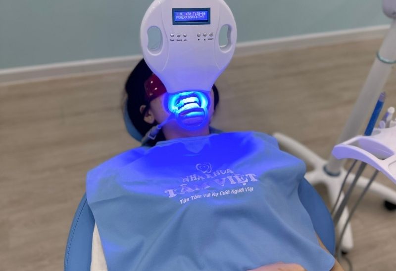 Tẩy trắng răng tại Tâm Việt