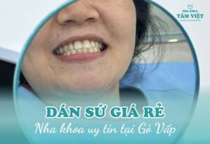 nha khoa dán sứ giá rẻ gần đây