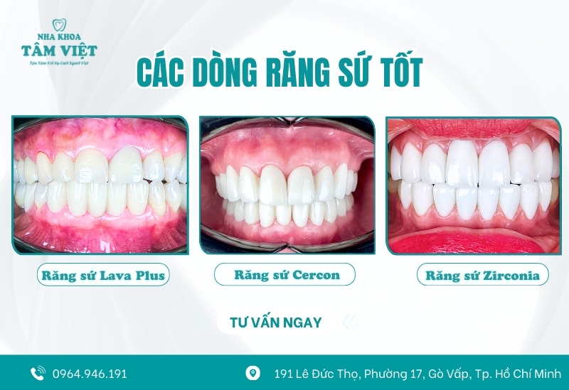 Vật liệu sứ chính hãng, bảo hành rõ ràng