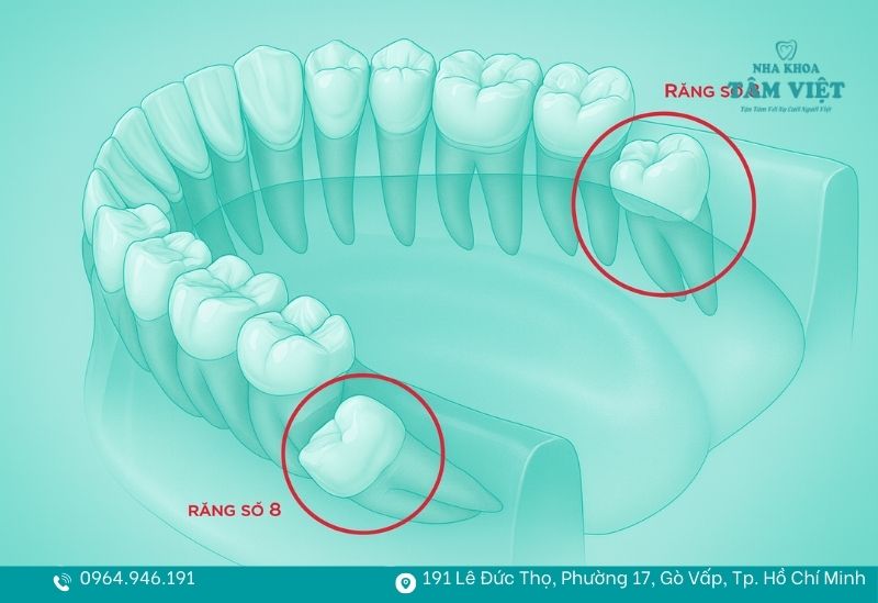 Răng số 8 hàm dưới