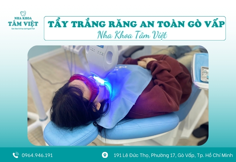 Tẩy trắng răng an toàn Gò Vấp giá tốt, bảo hành rõ ràng