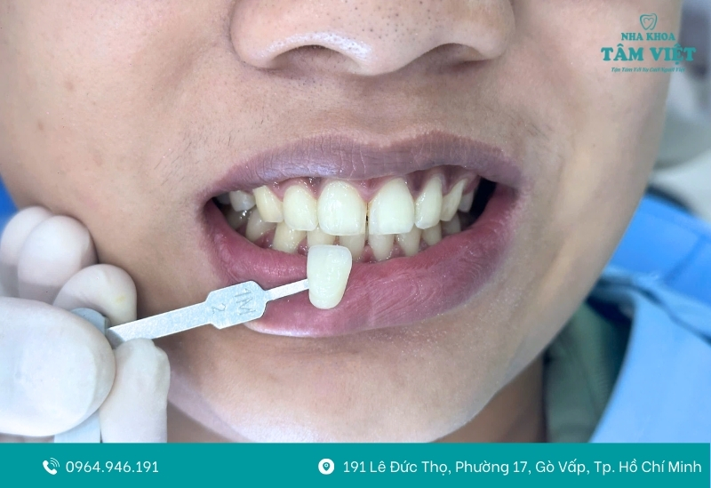 Khách hàng tự tin hơn với nụ cười sáng trắng