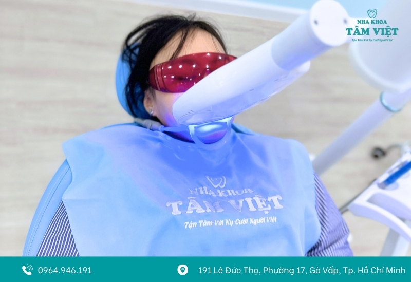 Tẩy trắng răng bao nhiêu phút là hợp lý?