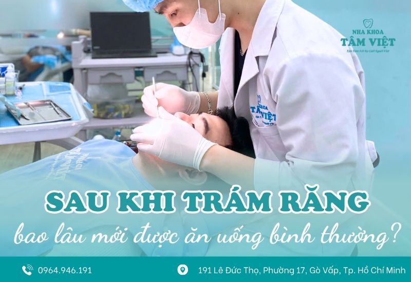 Trám răng xong bao lâu mới được ăn