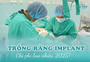 trồng răng implant chi phí bao nhiêu
