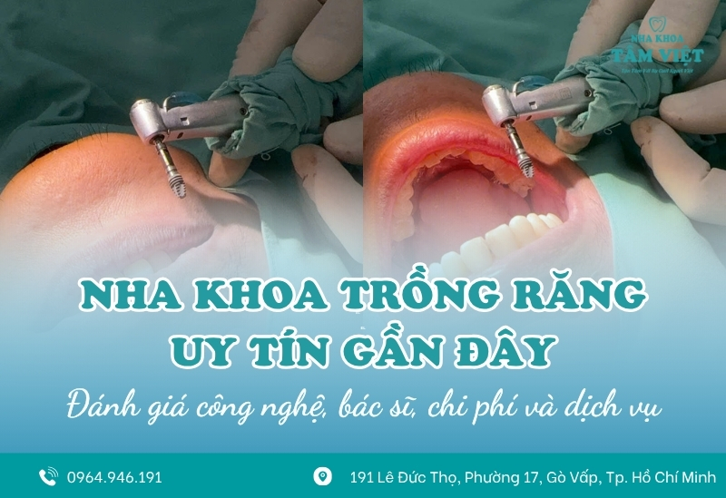 Review nha khoa trồng răng uy tín gần đây tại quận Gò Vấp 1 Review nha khoa trồng răng uy tín gần đây tại quận Gò Vấp