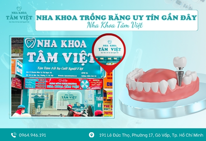 Nha khoa Tâm Việt – Nha khoa trồng răng uy tín gần đây tại Gò Vấp