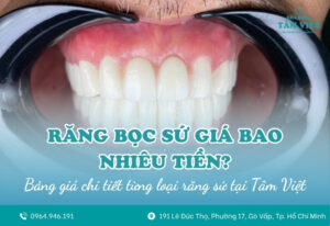 Răng bọc sứ giá bao nhiêu tiền cho 1 chiếc?