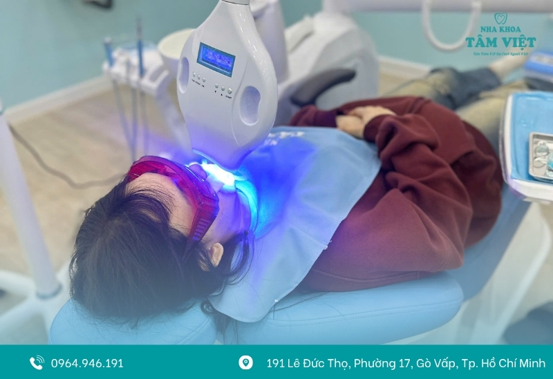 Công nghệ tẩy trắng răng hiện đại 