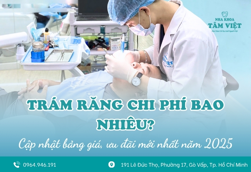 Trám răng chi phí bao nhiêu? Bảng giá mới nhất 2025 1 Trám răng chi phí bao nhiêu? Bảng giá mới nhất 2025