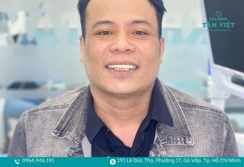 Bọc răng sứ không đen nướu tại Nha Khoa Tâm Việt