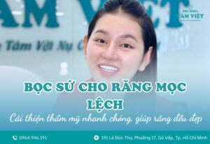 Có nên bọc sứ cho răng mọc lệch không?