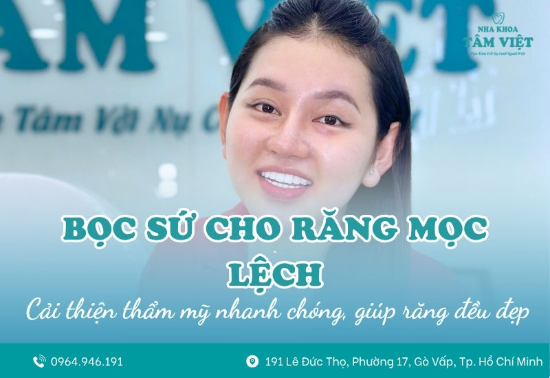 Có nên bọc sứ cho răng mọc lệch không? 1 Có nên bọc sứ cho răng mọc lệch không?