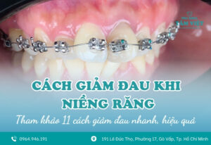 11 cách giảm đau khi niềng răng nhanh, hiệu quả
