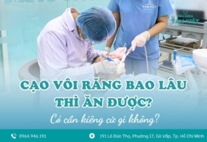 Cạo vôi răng bao lâu thì ăn được? Có kiêng gì không?