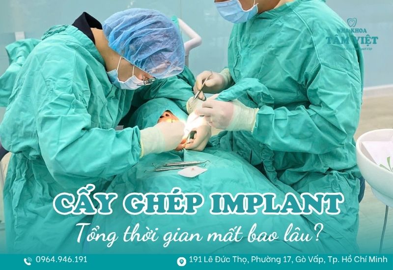 cấy ghép implant mất bao lâu