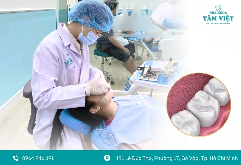 Trám răng composite hiện đại