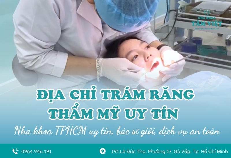 Địa chỉ trám răng thẩm mỹ uy tín tại TPHCM 1 Địa chỉ trám răng thẩm mỹ uy tín tại TPHCM