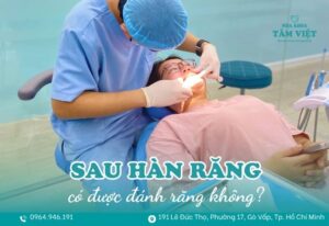 hàn răng xong có được đánh răng không
