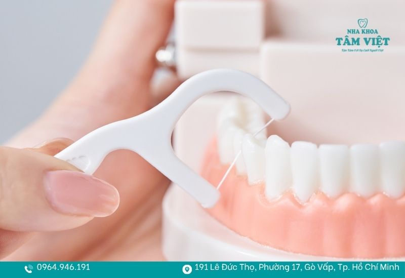 Kết hợp chỉ nha khoa 