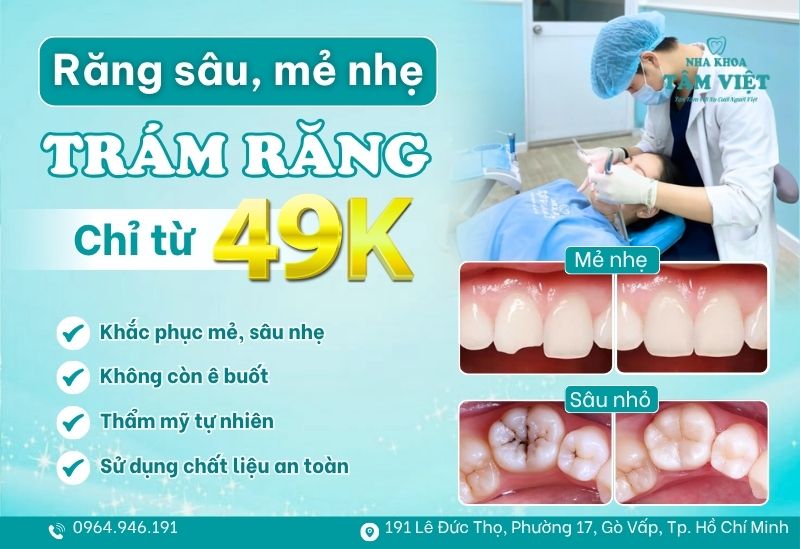 Hàn răng chỉ với 49K