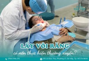 lay voi rang co tot khong 1 1