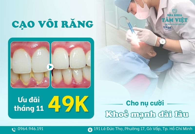Lấy vôi răng chuẩn y khoa chỉ với 49k