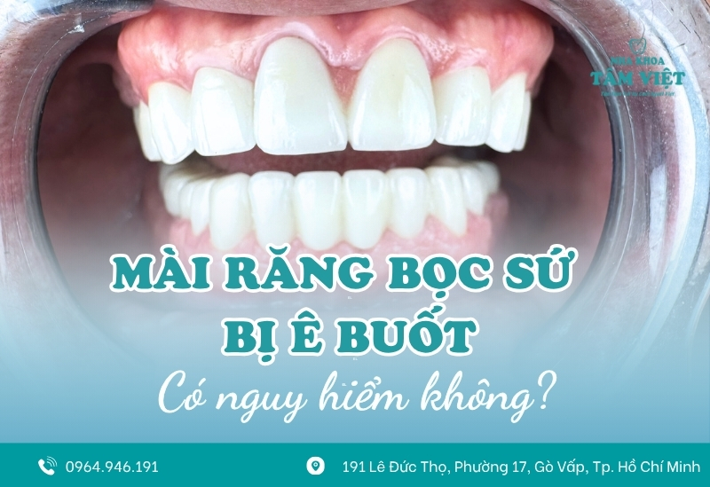 Tại sao mài răng bọc sứ bị ê buốt? Có nguy hiểm không? 1 Tại sao mài răng bọc sứ bị ê buốt? Có nguy hiểm không?