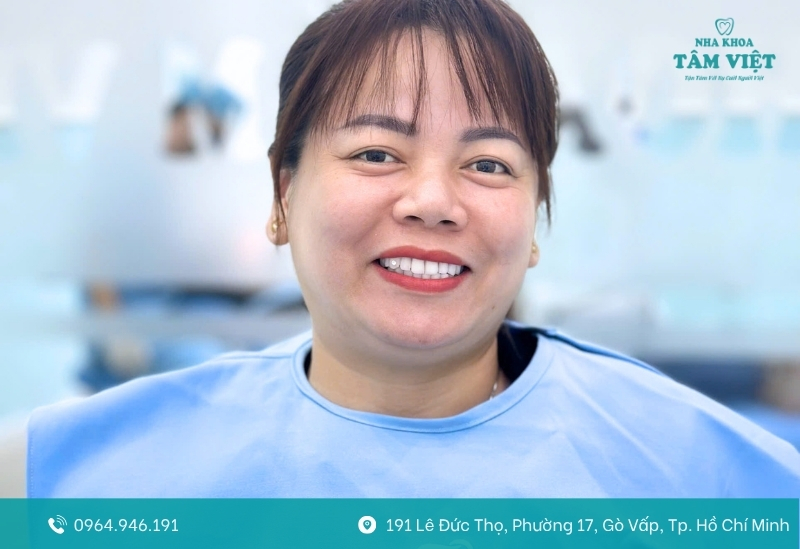 Mài răng bọc sứ là gì?