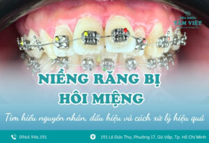 Cách xử lý khi niềng răng bị hôi miệng hiệu quả