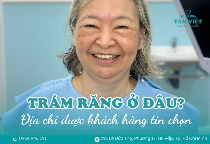 Trám răng ở đâu uy tín? Địa chỉ được khách hàng tin chọn 1 trám răng ở đâu uy tín