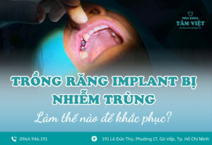 Dấu hiệu trồng răng implant bị nhiễm trùng và cách khắc phục
