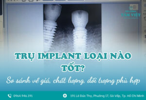 Trụ implant loại nào tốt? Implant hàn quốc hay implant mỹ?