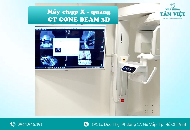Hệ thống máy chụp CT Cone Beam 3D hiện đại