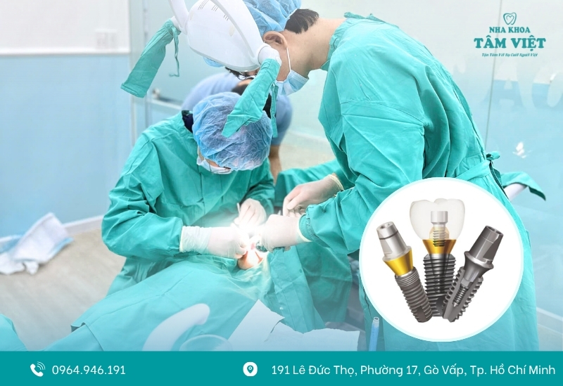 Implant Mỹ luôn giữ vị trí dẫn đầu