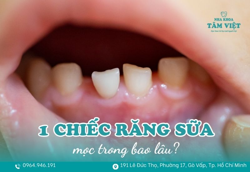 1 chiếc răng sữa mọc trong bao lâu và cách chăm sóc đúng 1 1 chiếc răng sữa mọc trong bao lâu