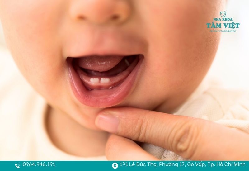 1 chiếc răng sữa mọc trong bao lâu và cách chăm sóc đúng 3 Răng cửa thường mọc nhanh và dễ dàng hơn