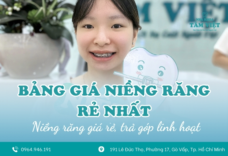 Bảng giá niềng răng rẻ nhất mới nhất hiện nay 1 Bảng giá niềng răng rẻ nhất mới nhất hiện nay