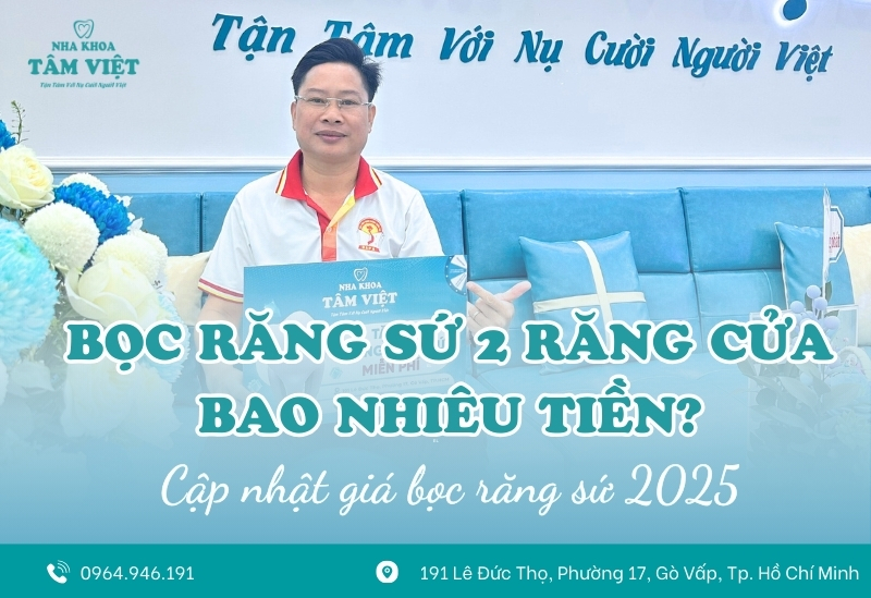 Bọc răng sứ 2 răng cửa bao nhiêu tiền? Bảng giá 2025 1 Bọc răng sứ 2 răng cửa bao nhiêu tiền? Bảng giá 2025
