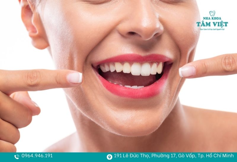 Cạo vôi răng có mòn răng không? Giải thích chi tiết 4 Cạo vôi răng không làm mèn mon răng