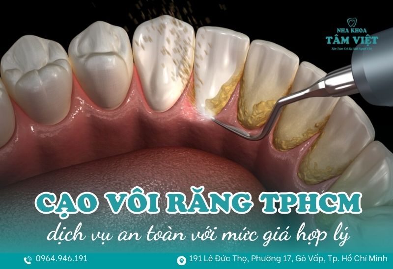 Cạo vôi răng ở đâu tốt TPHCM an toàn, giá hợp lý? 1 cạo vôi răng ở đâu tốt TPHCM