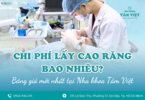 Chi phí lấy cao răng bao nhiêu? Cập nhật giá mới nhất