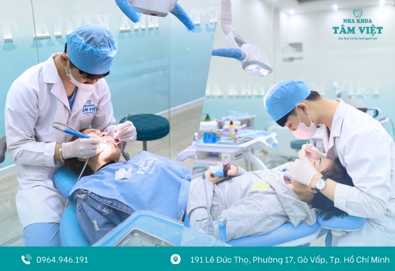 Chi phí lấy cao răng bao nhiêu? Cập nhật giá mới nhất 3 Trình độ bác sĩ và chế độ bảo hành