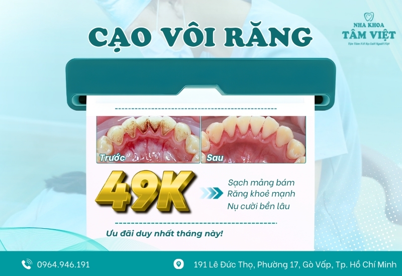 Chi phí lấy cao răng bao nhiêu? Cập nhật giá mới nhất 7 Cạo vôi răng chỉ từ 49.000đ