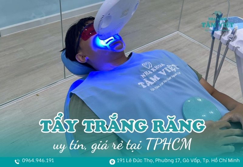 Địa chỉ tẩy trắng răng giá rẻ, uy tín tại TPHCM 1 địa chỉ tẩy trắng răng giá rẻ