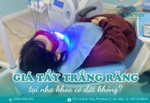 giá tẩy trắng răng tại nha khoa